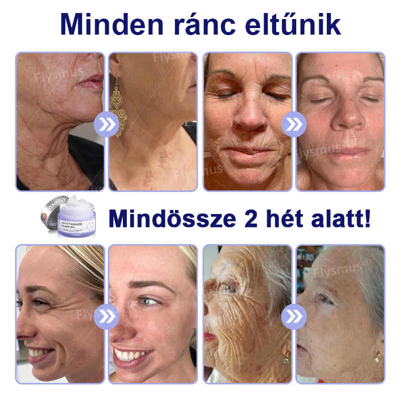 🌴🎁Ausztráliából készült és szállított - Flysmus® AH-8 Nyakfeszesítő és Lifting Krém