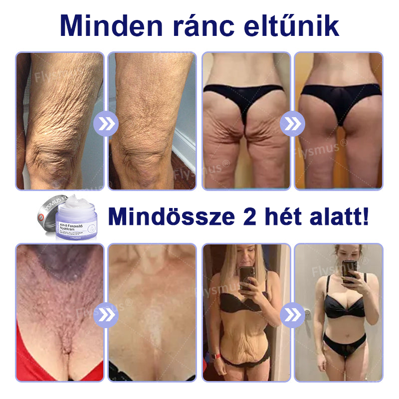 🌴🎁Ausztráliából készült és szállított - Flysmus® AH-8 Nyakfeszesítő és Lifting Krém