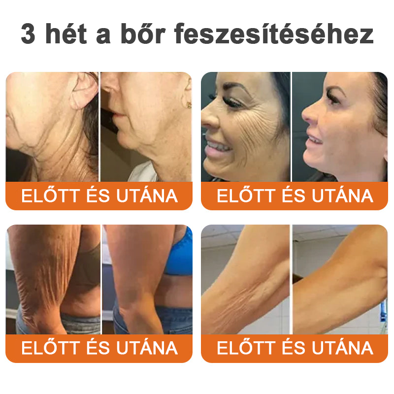 🌴🎁Ausztráliából készült és szállított - Flysmus® AH-8 Nyakfeszesítő és Lifting Krém
