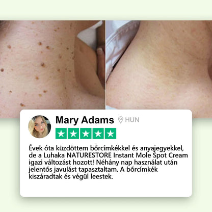 Luhaka® NATURE STORE Azonnali Anyajegy- és Pattanás elleni Krém_Ultra01