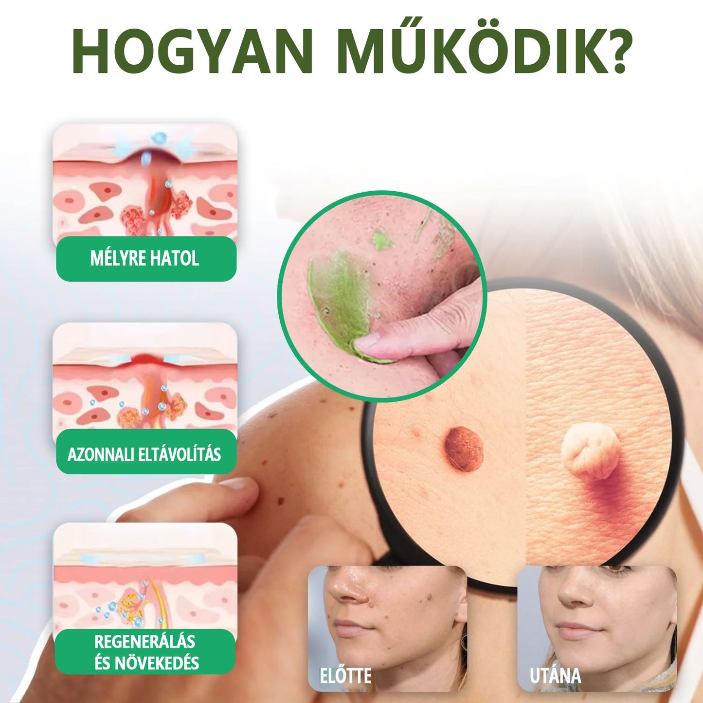 Luhaka® NATURE STORE Azonnali Anyajegy- és Pattanás elleni Krém_Ultra01
